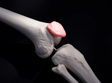 patello